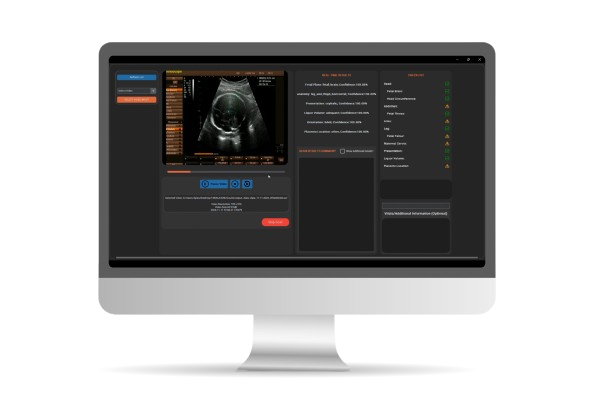 Tamela Health AI Solution Interface